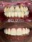 Eliz Dental Clinic - Eliz Dental Clinic - All-On-6 Treatment Before&After 
