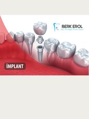 Dr. Berk EROL DDS PhD Oral Surgeon&Implantologist - Dental Implant