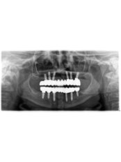 Dental X-Ray - DentaPoint | Dental Hospital
