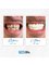 Medlife Group - Dentist Urla - Yelaltı Mahallesi, Nur Dikmen Cd. No:14, Urla, Turkey, 35430,  20