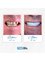 Medlife Group - Dentist Urla - Yelaltı Mahallesi, Nur Dikmen Cd. No:14, Urla, Turkey, 35430,  19