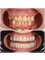 My Nova Dental Clinic- Izmir - Izmir Address: İmbatli, 6076. Sk. No:12 D:F, 35575, Karsiyaka/Izmir, 09400,  59