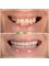 My Nova Dental Clinic- Izmir - Izmir Address: İmbatli, 6076. Sk. No:12 D:F, 35575, Karsiyaka/Izmir, 09400,  60
