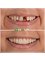 My Nova Dental Clinic- Izmir - Izmir Address: İmbatli, 6076. Sk. No:12 D:F, 35575, Karsiyaka/Izmir, 09400,  61