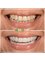 My Nova Dental Clinic- Izmir - Izmir Address: İmbatli, 6076. Sk. No:12 D:F, 35575, Karsiyaka/Izmir, 09400,  62