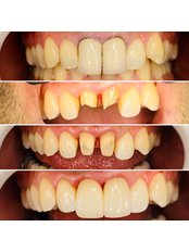 Dentist Consultation - Qklinik
