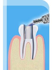 Endodontist Consultation - Tooth & Implant Dental Clinic