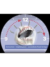 Immediate Implant Placement - Tooth & Implant Dental Clinic
