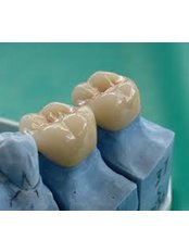 Dental Crowns - Tooth & Implant Dental Clinic