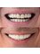 Dent Halikarnas Policlinic of Oral & Dental Health - konacık mah atatürk bulvarı no :203 C/1, bodrum, muğla, turkey, 48400,  10