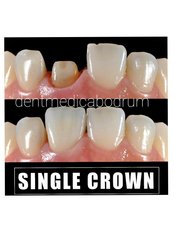 Zirconia Crown - Dent Medica Bodrum - Dr. Kübra Çakır