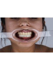 All-on-6 Dental Implants - DENT MEDICA BODRUM & Dr. ZİYA SARIYILDIZ