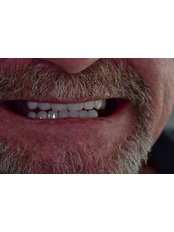 Zirconia Crown - MyndosDent Oral and Dental Clinic