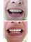 MyndosDent Oral and Dental Clinic - Teeth Whitening2 