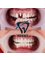 Dent48 Oral and Dental Health Clinics - KEMERALTI, ORG. MUSTAFA MUĞLALI CD. NO: 31/1, 48700 MARMARIS/MUĞLA, Marmaris, Mugla,  15