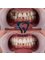 Dent48 Oral and Dental Health Clinics - KEMERALTI, ORG. MUSTAFA MUĞLALI CD. NO: 31/1, 48700 MARMARIS/MUĞLA, Marmaris, Mugla,  4