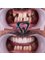 Dent48 Oral and Dental Health Clinics - KEMERALTI, ORG. MUSTAFA MUĞLALI CD. NO: 31/1, 48700 MARMARIS/MUĞLA, Marmaris, Mugla,  13
