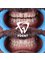 Dent48 Oral and Dental Health Clinics - KEMERALTI, ORG. MUSTAFA MUĞLALI CD. NO: 31/1, 48700 MARMARIS/MUĞLA, Marmaris, Mugla,  9