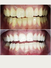 Minedentin Dental Clinic - Kemeraltı, Abdi Karataban Sok. No:25/A, 48700 Marmaris/Muğla, Muğla, Marmaris/Muğla, 48700, 