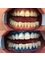 Minedentin Dental Clinic - Kemeraltı, Abdi Karataban Sok. No:25/A, 48700 Marmaris/Muğla, Muğla, Marmaris/Muğla, 48700,  2