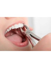 Extractions - Perfect Smile Dental Clinic Marmaris