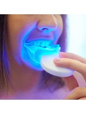 Home Whitening Kits - Perfect Smile Dental Clinic Marmaris