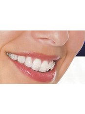 Orthodontist Consultation - The Smile Suite Clifton