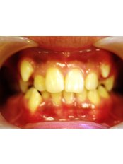 Orthodontist Consultation - Sarah Burns Orthodontics Marlow
