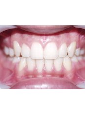 Orthodontist Consultation - Sarah Burns Orthodontics Marlow