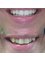 Smile Dental Practice - Wisbech - museum square dental, 4 Museum Square, The Crescent, Wisbech, Cambridgeshire, PE13 1ES,  2