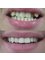 Smile Dental Practice - Wisbech - museum square dental, 4 Museum Square, The Crescent, Wisbech, Cambridgeshire, PE13 1ES,  3
