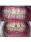 Smile Dental Practice - Wisbech - museum square dental, 4 Museum Square, The Crescent, Wisbech, Cambridgeshire, PE13 1ES,  6