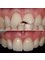 Precision Dental Clinic - Stockport - 284 Adswood Road, Stockport, SK3 8PN,  1