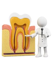 Root Canals - Billericay Dental Care