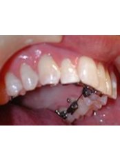 Initial Consultation with an Orthodontist - Herts Orthodontics