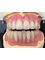 St George's Dental Laboratory - Customised Full/Full Dentures 