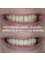 Mount Florida Dental - invisalign, whitening and composite bonding 