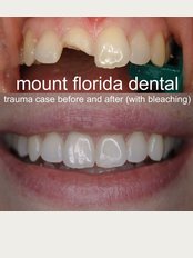 Mount Florida Dental - trauma case