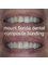 Mount Florida Dental - composite bonding 