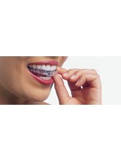 Dentist Consultation - Londent Oral Care