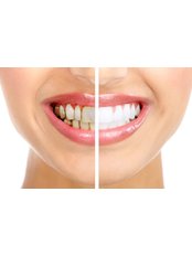 periodontal treatment - CBC Dental Studio