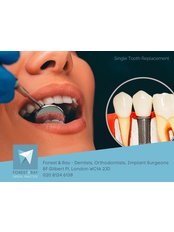 Single Implant - Forest & Ray - Dentists, Orthodontists, Implant Surgeons
