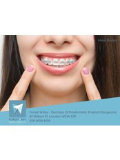 Metal Braces - Forest & Ray - Dentists, Orthodontists, Implant Surgeons