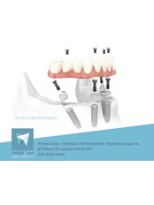 All-on-4 Dental Implants -One Arch - Forest & Ray - Dentists, Orthodontists, Implant Surgeons