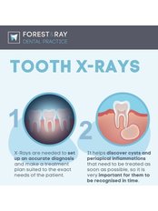 Dental X-Ray - Forest & Ray - Dentists, Orthodontists, Implant Surgeons
