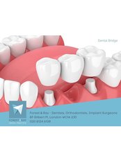 Dental Bridges - Forest & Ray - Dentists, Orthodontists, Implant Surgeons