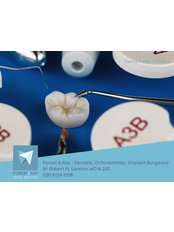 Inlay or Onlay - Forest & Ray - Dentists, Orthodontists, Implant Surgeons