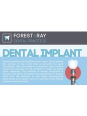 All-on-4 Dental Implants - Both Arched - Forest & Ray - Dentists, Orthodontists, Implant Surgeons