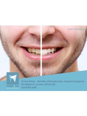 Teeth Whitening - Forest & Ray - Dentists, Orthodontists, Implant Surgeons
