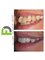 Fresh Dental - London - 22 Russell Court, Woburn Place, Bloomsbury, London, WC1H 0LL,  16